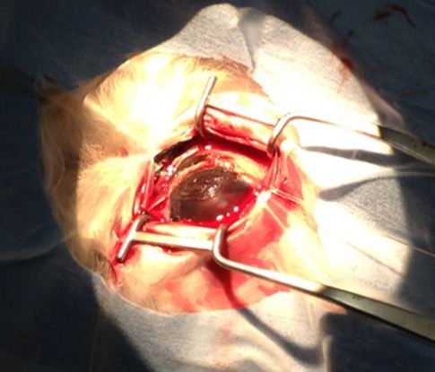 Right eye immediately after excision, but before cryosurgery and grafting